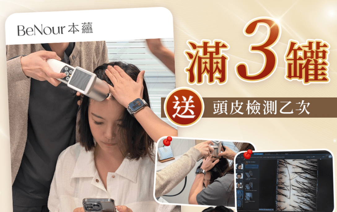 【2026最新】本蘊膠囊團購｜7/1官方即將調價！獨家專利成分nourel 諾瑞歐，全網最低價最後入手機會，優惠、心得、購買攻略一次看